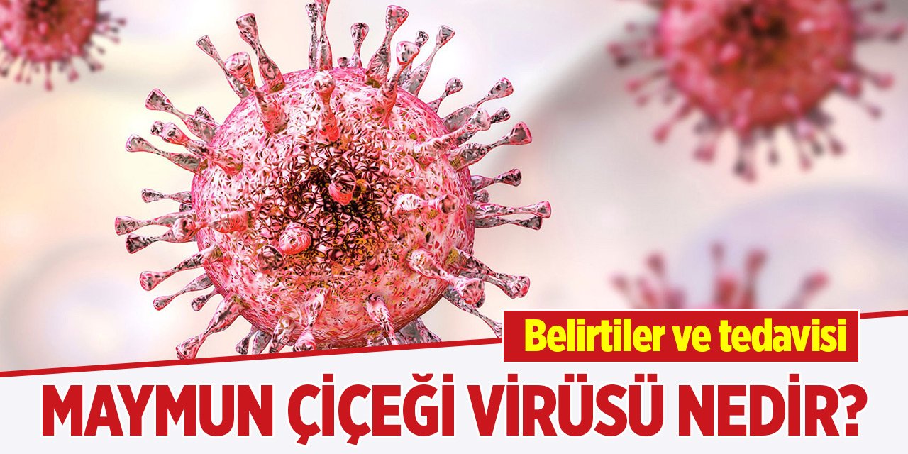 Maymun Çiçeği virüsü nedir? Belirtiler ve tedavisi