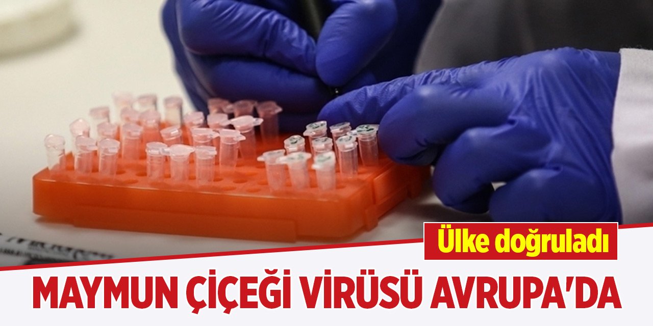 Maymun çiçeği virüsü Avrupa'da görüldü! Ülke doğruladı