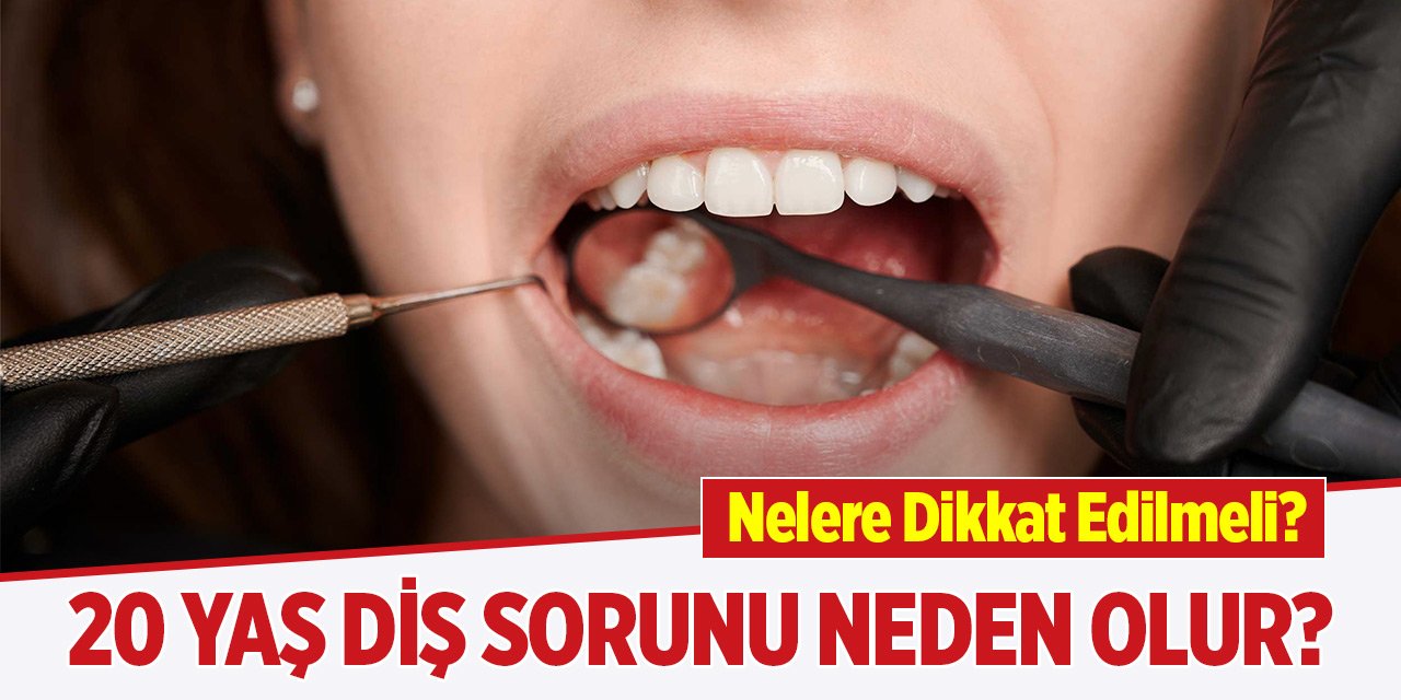 20 Yaş diş sorunu neden olur? Nelere dikkat edilmeli?